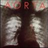 Aorta